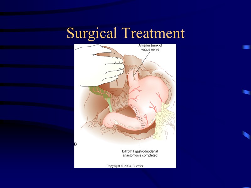 Surgical Treatment